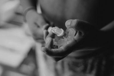 Costi sanità Italia: malattie cardiovascolari raggiungono il 50%